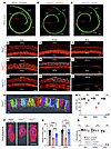 AAV2–SaCas9–sgRNA-1 adult injection rescues OHC and IHC length in P2rx2V61L/+ mouse model of DFNA41. AAV2–SaCas9–sgRNA-1 adult injection rescues OHC and IHC length in P2rx2V61L