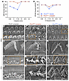AAV2–SaCas9–sgRNA-1 rescues HC morphology in the P2rx2V61L/+ mouse model of DFNA41. AAV2–SaCas9–sgRNA-1 rescues HC morphology in the P2rx2V61L/+ mouse model of
