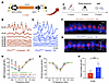 AAV2–SaCas9–sgRNA-1 injection attenuates increased sensitivity to NIHL in a P2rx2V61L/+ mouse model of DFNA41. AAV2–SaCas9–sgRNA-1 injection attenuates increased sensitivity to NIHL in a