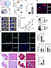 Carmn expression is reduced with limb ischemia and deficiency of Carmn-impaired perfusion recovery after hindlimb ischemia in mice. Carmn expression is reduced with limb ischemia and deficiency of Carmn-impa