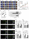 Delivery of miR-143-3p in vivo rescued revascularization in hindlimb ischemia. Delivery of miR-143-3p in vivo rescued revascularization in hindlimb ischem