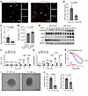 SMC-derived Carmn expression promotes EC proliferation and angiogenesis. SMC-derived Carmn expression promotes EC proliferation and angiogenesis.
