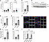 Carmn regulates Hhip expression in vitro and in vivo. Carmn regulates Hhip expression in vitro and in vivo.