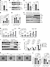 Hhip targets Hedgehog Signaling Pathway to mediate angiogenic changes in mECs. Hhip targets Hedgehog Signaling Pathway to mediate angiogenic changes in mE