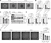 Inhibition of the Hedgehog signaling pathway in WT SMCs can phenocopy the antiangiogenetic effects of Carmn-KO SMCs. Inhibition of the Hedgehog signaling pathway in WT SMCs can phenocopy the a