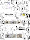 Carmn can inhibit the expression of Hhip through miR-143-3p signaling. Carmn can inhibit the expression of Hhip through miR-143-3p signaling.