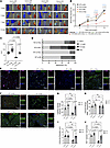 Delivery of siRNA targeting Hhip rescued revascularization in hindlimb ischemia. Delivery of siRNA targeting Hhip rescued revascularization in hindlimb isch