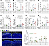 Enhanced antitumor immunity by CDK4/6i and CDK7i treatment. Enhanced antitumor immunity by CDK4/6i and CDK7i treatment.