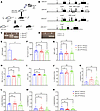 Slfn14 PF4-Cre mice generated using a Cre/LoxP conditional KO system have mild macrothrombocytopenia. Slfn14 PF4-Cre mice generated using a Cre/LoxP conditional KO system have m