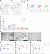 In vitro assessment of platelet size and glycoprotein levels and TEM of platelets in Slfn14 PF4-Cre mice. In vitro assessment of platelet size and glycoprotein levels and TEM of pla