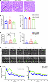 In situ MK assessment, tail bleeding, and laser injury–induced thrombus formation in Slfn14fl/fl PF4-Cre mice. In situ MK assessment, tail bleeding, and laser injury–induced thrombus for