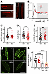 Accessible membrane cholesterol is concentrated at the IDs in cardiomyocytes and is regulated by FGF13. Accessible membrane cholesterol is concentrated at the IDs in cardiomyocyte