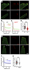 FGF13 and cholesterol regulate NaV1.5 at the ID. FGF13 and cholesterol regulate NaV1.5 at the ID.