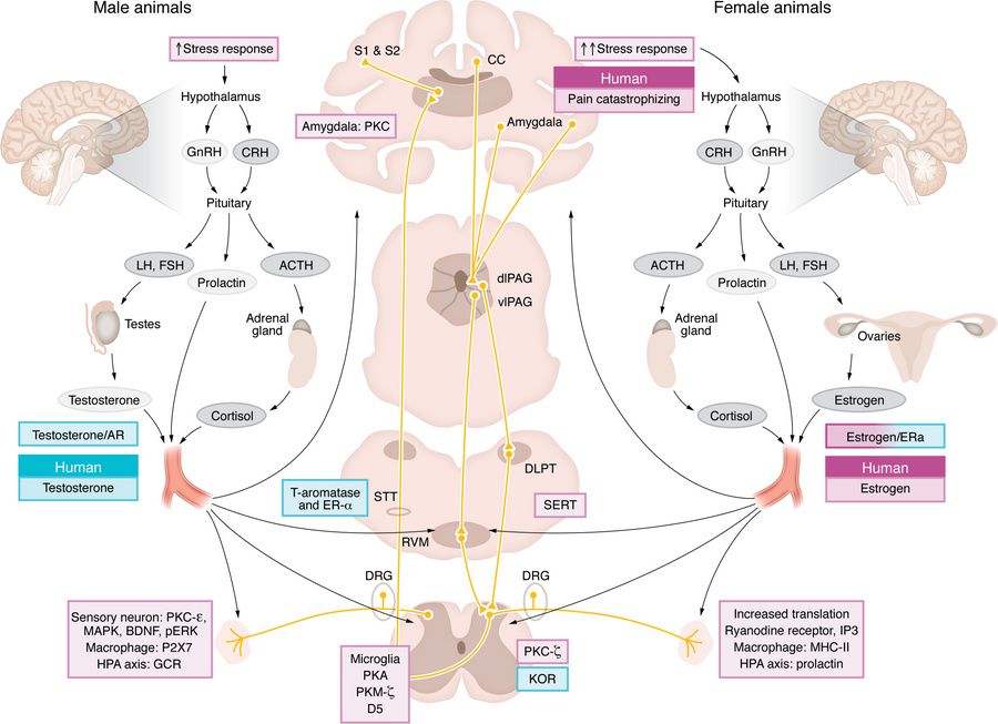 Jci Sex Differences In The Transition To Chronic Pain