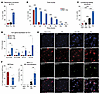 Keratinocytes induce healthy neutrophils to adopt an APC-like state. Keratinocytes induce healthy neutrophils to adopt an APC-like state.
