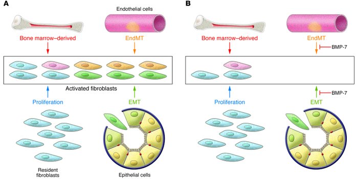 Origin of fibroblasts during fibrosis and its reversal by BMP-7.
(A) Dif...