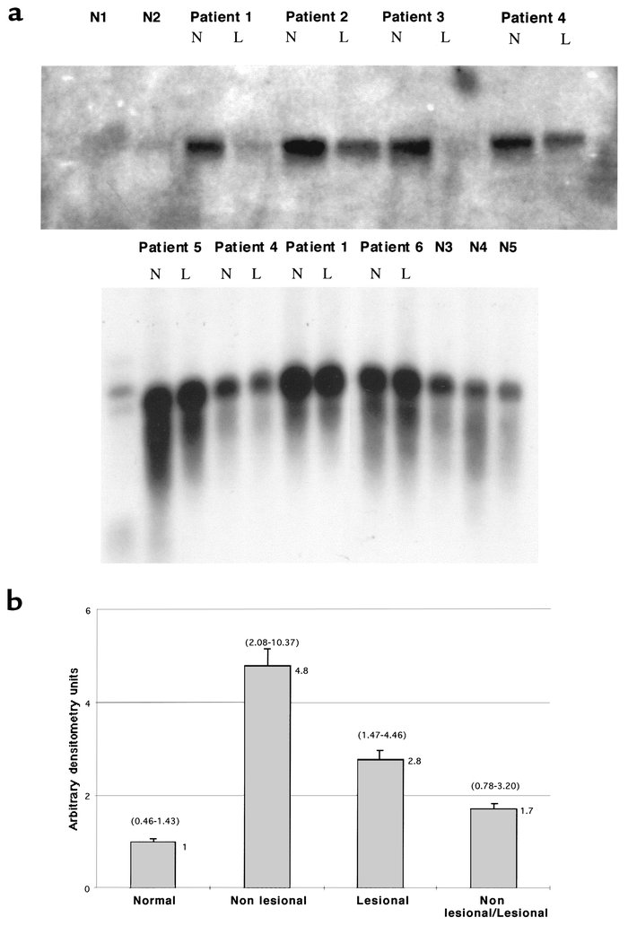 (a) Northern blots using total RNA isolated from human dermal fibroblast...