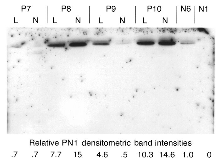Media (conditioned for 48 h) from four scleroderma fibroblast lines, P7–...