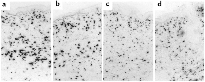 Bright-field views of in situ hybridization to scleroderma (a and b) and...
