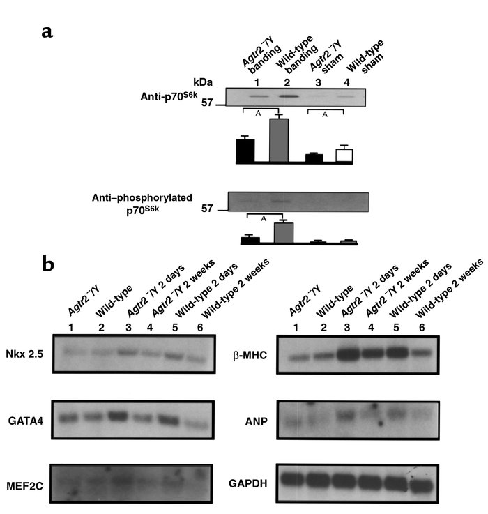 (a) Phosphorylated p70S6k and total p70S6k in the Agtr2–/Y and wild-type...