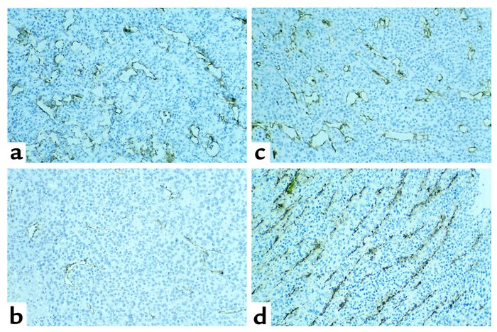 Role of IFN-γ in the antivascular activity of IL-12/pulse IL-2 against i...