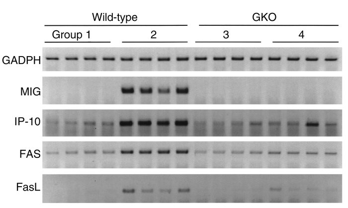 Impact of IL-12/pulse IL-2 administration on local gene expression withi...