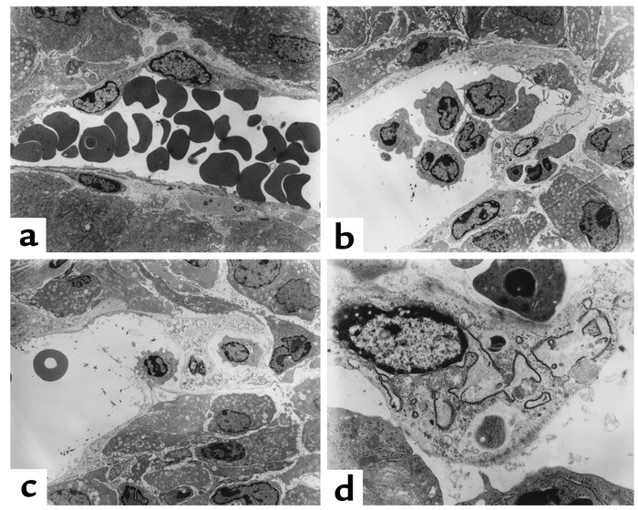 Impact of administration of IL-12/pulse IL-2 on the ultrastructural hist...