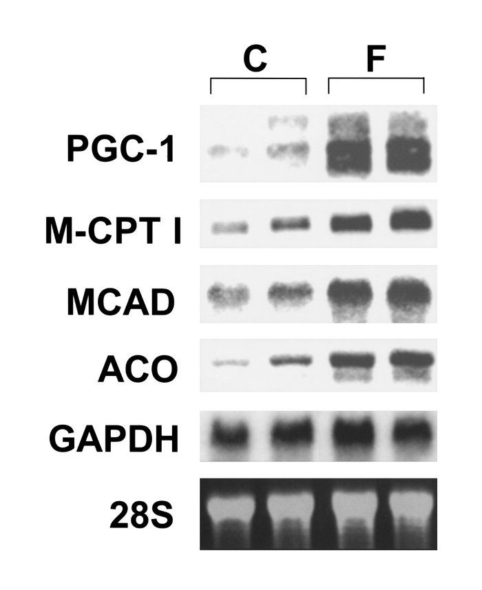 Induction of cardiac PGC-1 gene expression during short-term starvation....
