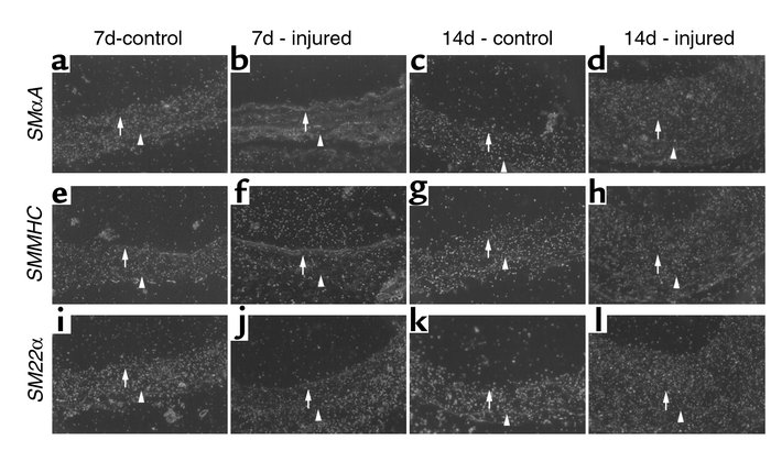 In situ hybridization analyses of SMαA, SMMHC, and SM22α at 7 and 14 day...