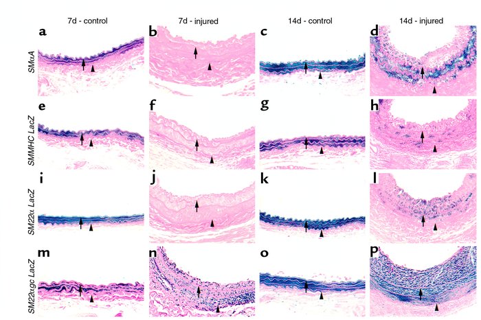 β-Galactosidase staining of mouse carotid arteries from SMαA (a–d), SMMH...