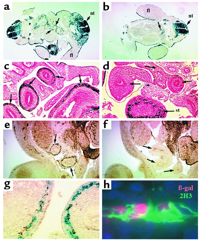 Enteric ganglia are deficient in Splotch intestine. (a and b) Transverse...