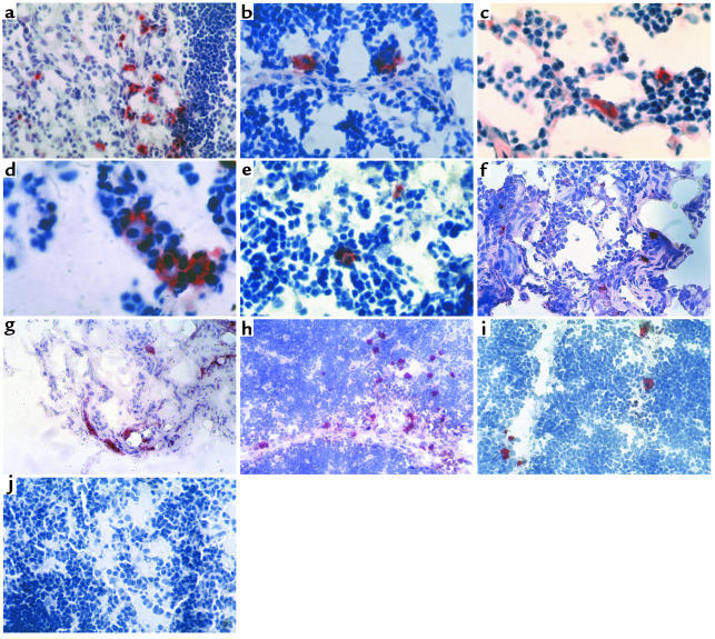 Self-antigen–expressing cells in human thymus. Immunostaining of thymus ...