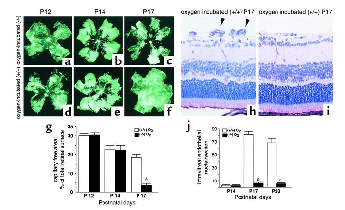 Quantification of ischemic retina (a–g) and intravitreal neovascularizat...