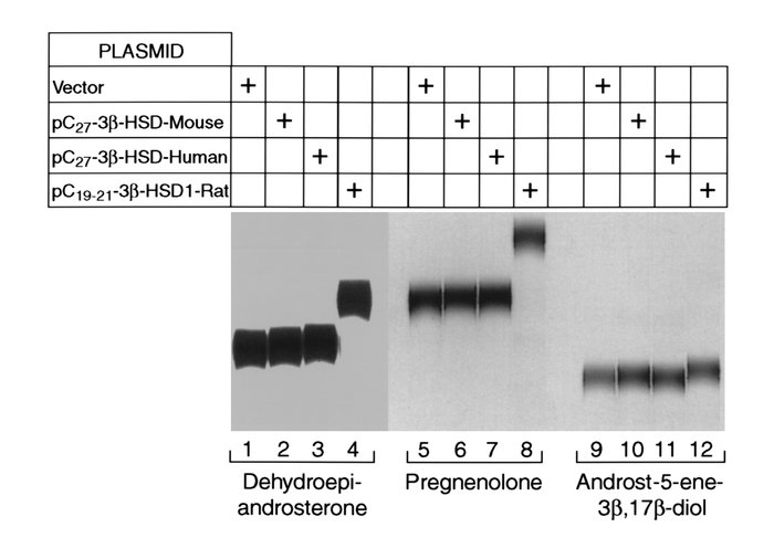 Activities of different 3β-HSD enzymes against C19/21 steroid substrates...