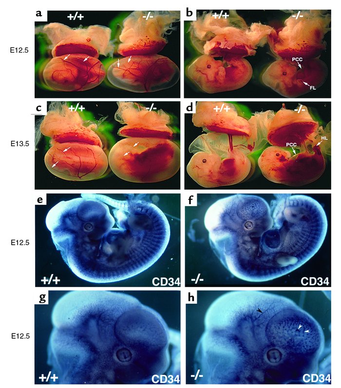 Phenotype of Edg1–/– embryos and normal vascular network in the Edg1–/– ...