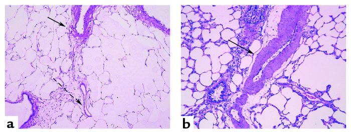 Pulmonary vascular morphology of vehicle-treated (a) or SU5416-treated (...