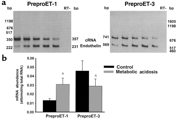 Acid feeding increases preproET-1 mRNA expression in wild-type mice. C57...