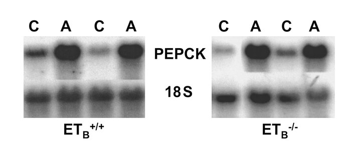 Acid feeding increases PEPCK mRNA in Tg/Tg:ETB+/+ and Tg/Tg:ETB–/– mice....