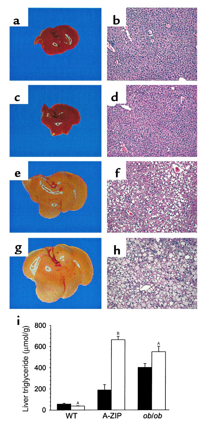 Rosiglitazone exacerbates hepatic steatosis. Livers from WT (a–d) and A-...