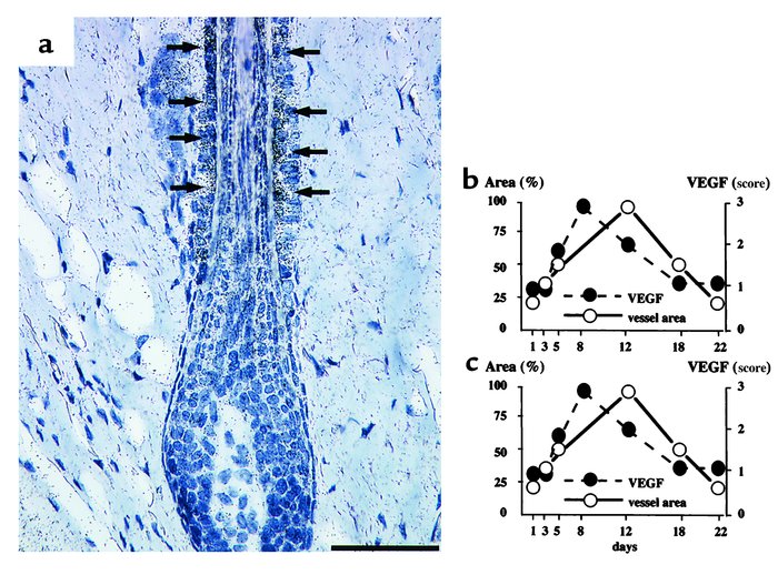 (a) In situ hybridization demonstrates strong VEGF mRNA expression in fo...