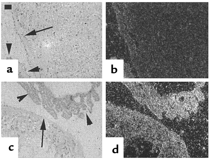 PTHrP in situ hybridization of placenta. Respective bright-field and dar...