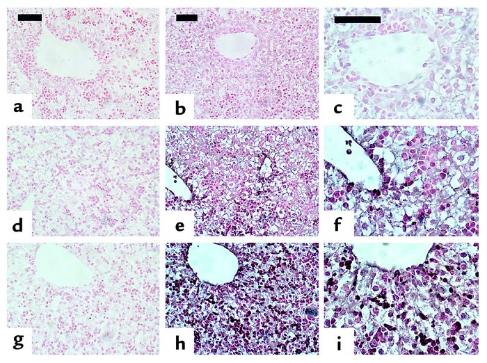 PTHrP immunohistochemistry of fetal liver. Upper images (a–c) are from P...