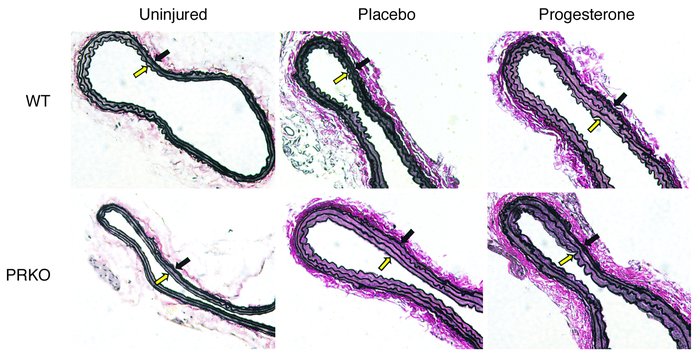 Elastin-stained sections of uninjured and injured WT and PRKO mouse caro...