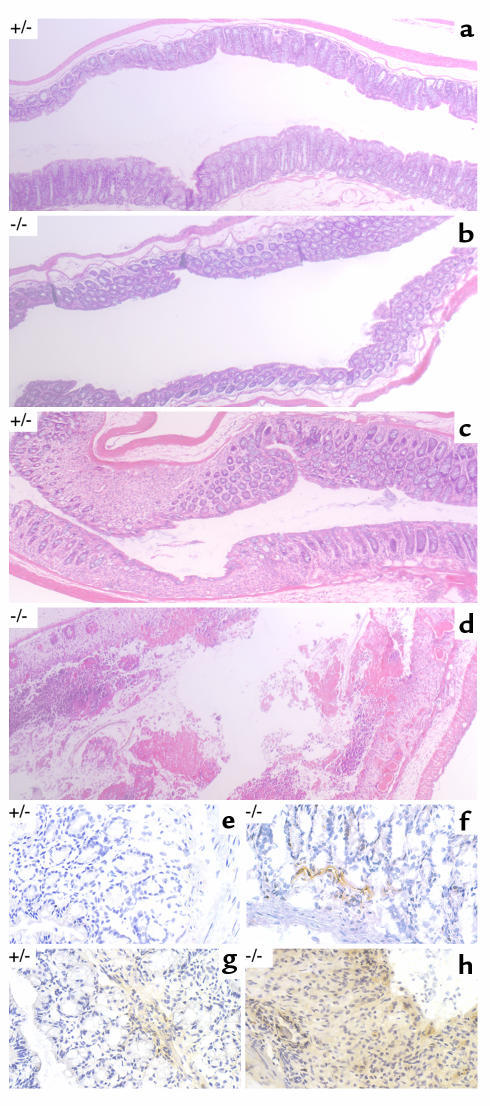 Histopathology of DSS-treated mice. Representative photomicrographs (×50...