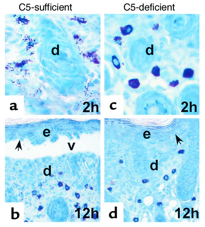 MC degranulation depends on complement activation. Neonatal C5-sufficien...