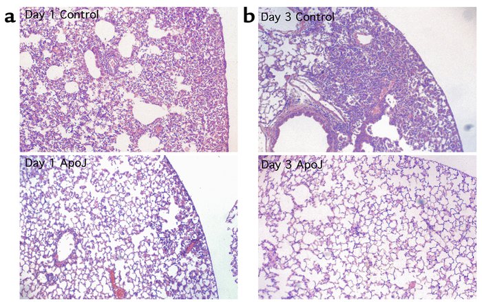Reduction in inflammation in the lungs. LPS-stimulated lung sections fro...