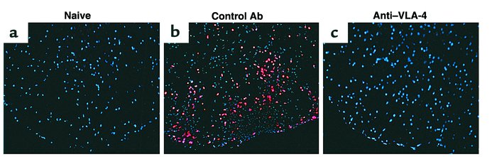 Preclinical administration of anti–VLA-4 blocks infiltration of CD4+ T c...
