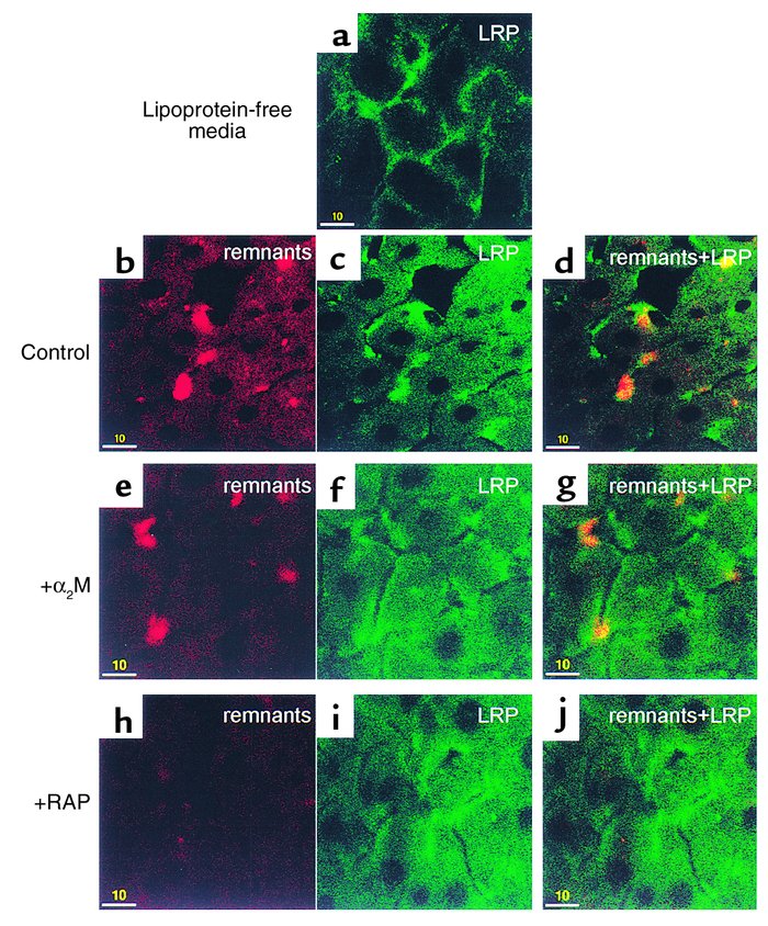 Effect of LRP competitors on LRP distribution and chylomicron remnant up...