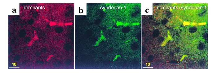Syndecans colocalize with clusters of chylomicron remnants. Ldlr–/– live...