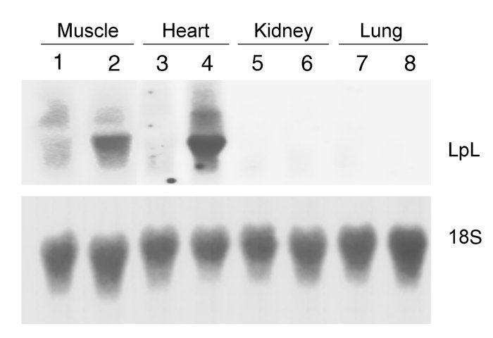 LpL RNA tissue levels of hLpLHBM and hLpL transgenic mice on the LpL kno...